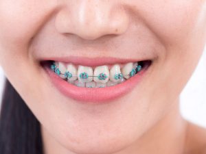 GettyImages-736838629-5adcaa4d3128340036f9daea