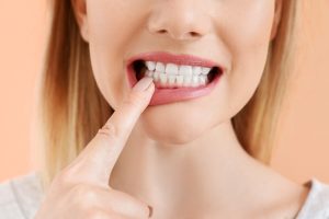 Prevent Gum Disease